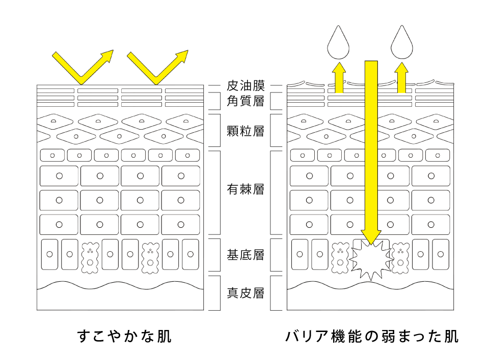 すこやかな肌 / バリア機能の弱まった肌